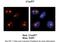 Chromatin Target Of PRMT1 antibody, PA5-44307, Invitrogen Antibodies, Immunohistochemistry frozen image 