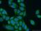 Chitobiosyldiphosphodolichol beta-mannosyltransferase antibody, 12872-1-AP, Proteintech Group, Immunofluorescence image 