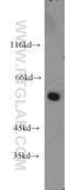 Netrin receptor UNC5D antibody, 20241-1-AP, Proteintech Group, Western Blot image 