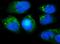 Methylmalonyl-CoA Mutase antibody, A01065, Boster Biological Technology, Immunofluorescence image 