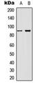 Catenin Beta 1 antibody, abx133057, Abbexa, Western Blot image 