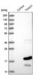 TSSK6 Activating Cochaperone antibody, NBP2-33923, Novus Biologicals, Western Blot image 