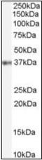 Homeobox protein GBX-2 antibody, orb89304, Biorbyt, Western Blot image 