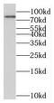 Mesoderm induction early response protein 1 antibody, FNab05184, FineTest, Western Blot image 