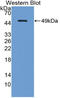 CD218b antibody, LS-C314808, Lifespan Biosciences, Western Blot image 