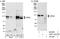 5'-3' Exoribonuclease 2 antibody, A301-101A, Bethyl Labs, Immunoprecipitation image 