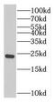 Troponin I2, Fast Skeletal Type antibody, FNab08840, FineTest, Western Blot image 