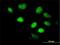 LIM Homeobox 5 antibody, H00064211-M05, Novus Biologicals, Immunofluorescence image 