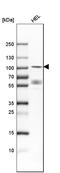DYRK1A antibody, HPA015810, Atlas Antibodies, Western Blot image 