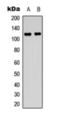 Fibroblast Growth Factor Receptor 1 antibody, orb393289, Biorbyt, Western Blot image 