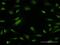 Zinc finger and BTB domain-containing protein 25 antibody, MA5-24567, Invitrogen Antibodies, Immunofluorescence image 