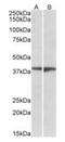 NRG-1 antibody, orb137168, Biorbyt, Western Blot image 