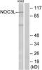 NOC3 Like DNA Replication Regulator antibody, TA315722, Origene, Western Blot image 