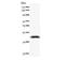Mediator Complex Subunit 17 antibody, LS-C342429, Lifespan Biosciences, Western Blot image 