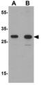 T Cell Leukemia Homeobox 3 antibody, GTX31542, GeneTex, Western Blot image 