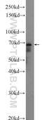 Serine Active Site Containing 1 antibody, 25729-1-AP, Proteintech Group, Western Blot image 