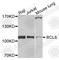 B-cell lymphoma 6 protein antibody, A7173, ABclonal Technology, Western Blot image 