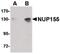Nucleoporin 155 antibody, PA5-20564, Invitrogen Antibodies, Western Blot image 