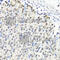 Heterogeneous Nuclear Ribonucleoprotein A1 antibody, A7491, ABclonal Technology, Immunohistochemistry paraffin image 