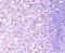 Polypyrimidine Tract Binding Protein 1 antibody, NBP2-75635, Novus Biologicals, Immunohistochemistry paraffin image 