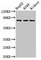Ubiquitin Interaction Motif Containing 1 antibody, CSB-PA857019LA01HU, Cusabio, Western Blot image 