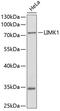 LIM Domain Kinase 1 antibody, 13-200, ProSci, Western Blot image 