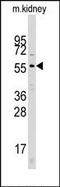 Cell Division Cycle 25A antibody, AP13254PU-N, Origene, Western Blot image 