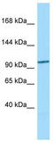 Coiled-Coil Domain Containing 66 antibody, TA332266, Origene, Western Blot image 