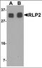 RILP-like protein 2 antibody, orb137315, Biorbyt, Western Blot image 