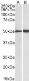 Fibrinogen Gamma Chain antibody, TA348962, Origene, Western Blot image 