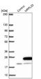 Mitochondrial Ribosomal Protein L20 antibody, NBP1-92138, Novus Biologicals, Western Blot image 