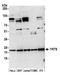 YKT6 V-SNARE Homolog antibody, A305-479A, Bethyl Labs, Western Blot image 