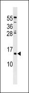 HERV-H LTR-Associating 3 antibody, LS-C159829, Lifespan Biosciences, Western Blot image 