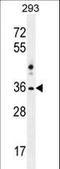 NK1 Homeobox 2 antibody, LS-C164894, Lifespan Biosciences, Western Blot image 