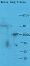ERCC Excision Repair 3, TFIIH Core Complex Helicase Subunit antibody, orb100079, Biorbyt, Western Blot image 