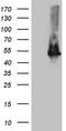Twinfilin Actin Binding Protein 1 antibody, TA808893S, Origene, Western Blot image 