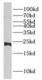 Gamma-Glutamylcyclotransferase antibody, FNab03443, FineTest, Western Blot image 