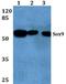 SRY-Box 9 antibody, A00177, Boster Biological Technology, Western Blot image 