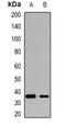 Potassium Channel Tetramerization Domain Containing 15 antibody, orb341460, Biorbyt, Western Blot image 