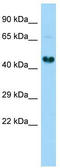 Ganglioside Induced Differentiation Associated Protein 1 Like 1 antibody, TA338644, Origene, Western Blot image 