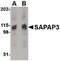 Disks large-associated protein 3 antibody, PA5-20465, Invitrogen Antibodies, Western Blot image 