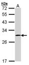 FHL-2 antibody, NBP1-31262, Novus Biologicals, Western Blot image 