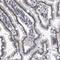 Nucleoporin 35 antibody, HPA018441, Atlas Antibodies, Immunohistochemistry frozen image 