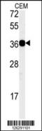 CD300 Molecule Like Family Member B antibody, 61-831, ProSci, Western Blot image 