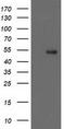 Glucosylceramidase Beta 3 (Gene/Pseudogene) antibody, TA502542, Origene, Western Blot image 