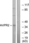 DIR antibody, TA313495, Origene, Western Blot image 