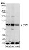 Pre-rRNA-processing protein TSR1 homolog antibody, A305-112A, Bethyl Labs, Western Blot image 