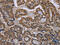 NPHS2 Stomatin Family Member, Podocin antibody, CSB-PA579527, Cusabio, Immunohistochemistry paraffin image 