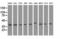 3-Hydroxyisobutyryl-CoA Hydrolase antibody, LS-C115376, Lifespan Biosciences, Western Blot image 