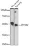 ANTXR Cell Adhesion Molecule 2 antibody, GTX33011, GeneTex, Western Blot image 